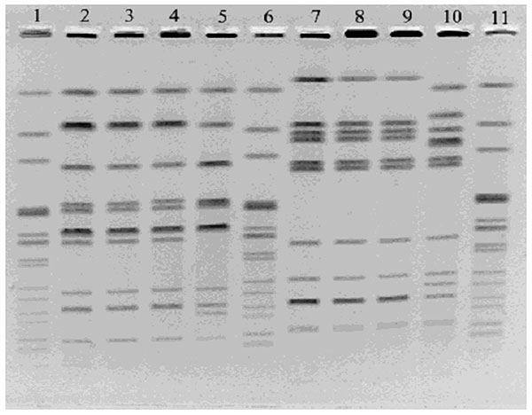 Pulsed-field gel electrophoresis of Salmonella enterica serotype Enteritidis isolates from Biorat and Ratin products using XbaI (lanes 2–5) and BlnI (lanes 7–10). Lanes 1, 6, and 11, molecular weight standard strain AM01144; lanes 2 and 7, Biorat isolate from 1998; lanes 3 and 8, Biorat isolate from 1995; lanes 4 and 9, Biorat isolate from 2001; lanes 5 and 10, Ratin isolate.