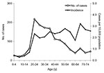 Thumbnail of Number of patients with severe acute respiratory syndrome by age, and age-specific incidence (per 10,000 population), November 1, 2002–April 30, 2003, Guangdong Province, China.