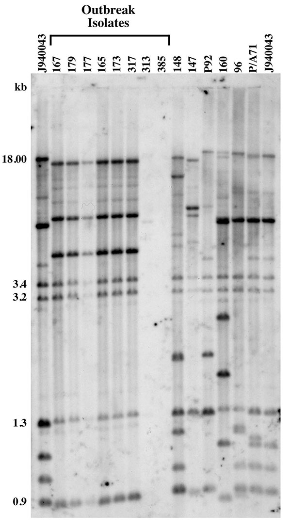 Genetic analysis of Candida parapsilosis clinical isolates. Southern blot hybridization patterns of the 14 C. parapsilosis test isolates were probed with the Cp3-13 DNA fingerprinting probe. The reference strain J940043 was run in the outer two lanes of the gel. Isolates associated with the hospital outbreak are indicated. Note that while isolates 167, 179, 177, 165, 173, and 317 displayed identical group I patterns, strains 313 and 385 showed patterns typical of non-group I strains with a lack