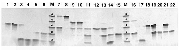 Representative denaturing gel electrophoresis analysis of Pneumocystis jirovecii tandem repeats in clinical isolates. Numbers above each lane represent individual isolates. Lane M is a mixture of polymerase chain reaction products from five isolates, of which the number of repeats was 2, 3, 4, 5, and 6 (shown above DNA bands), as determined by sequencing. Reprinted from (33) with permission from the University of Chicago Press.