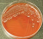 Thumbnail of Colonial morphology of Clostridium hathewayi on brucella blood agar media after 48 hours of anaerobic incubation.