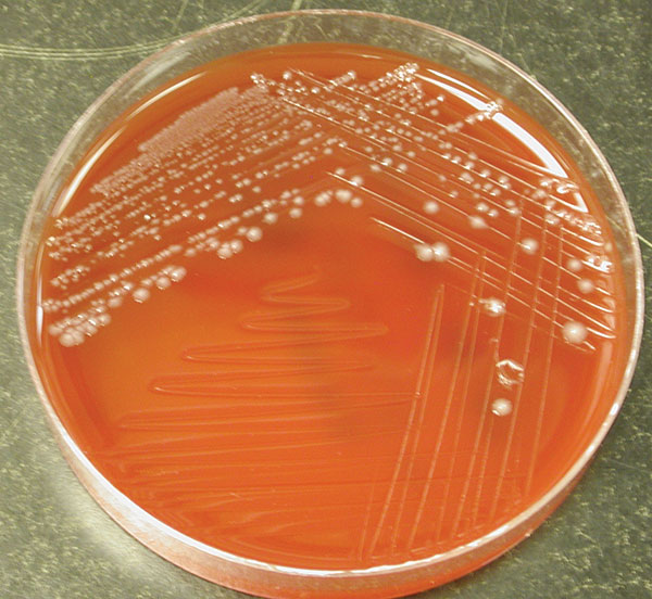 Colonial morphology of Clostridium hathewayi on brucella blood agar media after 48 hours of anaerobic incubation.