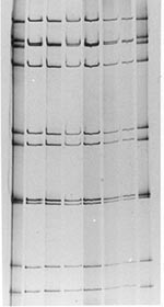 Thumbnail of Electrophoretic patterns of the dsRNA of G9P[8] rotavirus strains obtained from Australian children with acute gastroenteritis during the rotavirus outbreak, 2001. Electropherotypes of four representative G9P[8] strains isolated from children during the 2001 rotavirus outbreak are illustrated in part A. Lane 1, Alice Springs (Ob-AS-1); lane 2, Darwin (Ob-Dar-1); lane 3, Gove (Ob-Gv-1); and lane 4, Mount Isa (Ob-Gv-1). B) compares the electropherotypes of G9P[8] strains isolated from
