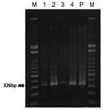 Thumbnail of Detection of the Japanese encephalitis virus E gene in cerebrospinal fluid from patients with meningitis. Lanes 1–4, patients Numbers 1–4; lane P, positive control (JaGAr#01); lane M, marker (100-bp ladder).
