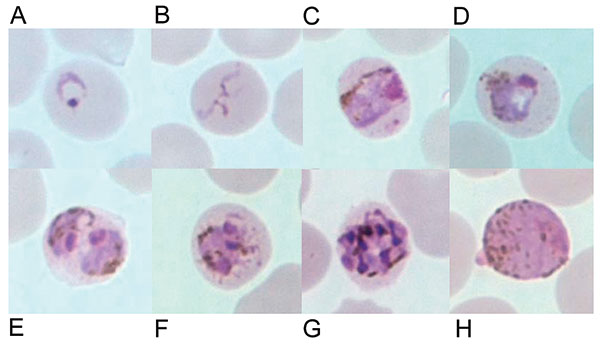 Giemsa-stained thin blood films depicting A) ring stage, B) tenue form of young trophozoite, C) band-shaped growing trophozoite, D) growing trophozoite with little or no amoeboid activity, E) double growing trophozoites, F) early schizont, G) late schizont in an erythrocyte with fimbriated margins, and H) mature macrogametocyte. Discernible Sinton and Mulligan stippling is in C, D, and F.
