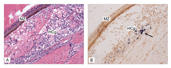 Covert Taura syndrome virus (TSV) infection (transition/chronic phase of TS disease) in indicator specific pathogen free–Litopenaeus vannamei shrimp was confirmed by in situ hybridization (ISH) with digoxigenin-labeled gene probes specific for detection of TSV. A) Histologic section through the dorsal cuticular epithelium showing a melanized resolving lesion (MZ) and hemolytic congestion (HCg), indicative of the transition phase of TSV infection (hematoxylin/eosin-phloxin stain; 50x) . B) TSV IS