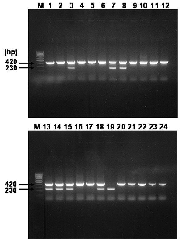 Agarose gel electrophoresis analysis on 1.5% agarose gel of DNA sequences amplified by multiplex-nested polymerase chain reaction (PCR) assay by using outer and inner primer sets targeted rompB gene and template DNAs from serum samples. Lanes: M, size marker DNA (100-bp DNA ladder); 1–24, each number of amplified H products. The number on the left indicates the molecular size (in bp) of the amplified PCR products.