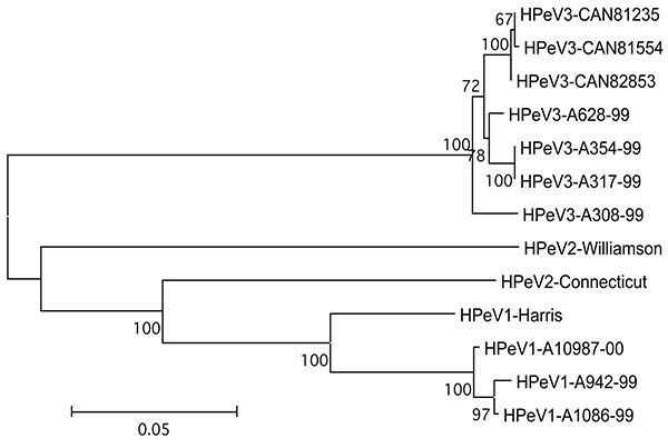 Phylogenetic tree showing the relationship between human parechovirus (HPeV)-3 Canadian isolates no. 81235, 81554, and 82853 and other HPeV-3 (A628-99, GenBank accession no. AB112484; A354-99, no. AB112483; A317-99, no. AB112482; A308-99, no. AB084913), HPeV-2 (Williamson, no. AJ005695; Connecticut, no. AF055846) and HPeV-1 (Harris, no. S45208; A10987-00, no. AB112487; A942-99, no. AB112486; A1086-99, no. AB112485) strains based on amino acid differences in capsid proteins (VP0-VP3-VP1 region).