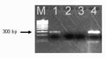 Thumbnail of Polymerase chain reaction amplification of Anaplasma phagocytophilum DNA from the patient's acute-phase blood sample. Amplified DNA was separated by electrophoresis through the 2% agarose gel stained with ethidium bromide. Lane 1, patient sample (note the presence of the band at ≈293 bp); lane 2, negative sample; lane 3, negative control (no-DNA template control); lane 4 positive control (DNA extracted from the cultured isolate of A. phagocytophilum). Lane M represents a 100-bp DNA 