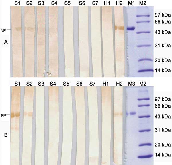 Detection of antibodies against severe acute respiratory syndrome (SARS)–associated coronavirus recombinant proteins in animal sera by Western blotting. Recombinant nuleocapsid protein in panel A (NP, 54 kilodaltons [kDa]) and partial spike protein in panel B (SP, 57 kDa) were used as antigens. Goat anti-swine immunoglobulin G horseradish peroxidase was used as a secondary antibody. Serum samples from a convalescent SARS patient and healthy persons were used as positive and negative controls, re