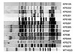 Thumbnail of Restriction fragment length polymorphism patterns of 12 Beijing strains from Karonga District, Malawi. All strains were &gt;79% related to at least 1 of the other Beijing strains found in the district. Strain MT14323 is a reference strain.