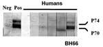 Thumbnail of Western blot analysis of human serum samples for evidence of simian foamy virus (SFV) antibodies. Antibodies to the gag precursor proteins (p70/p74) were apparent from the human BH66 blood sample, which indicated infection with SFV. Positive control is an SFV-infected baboon.