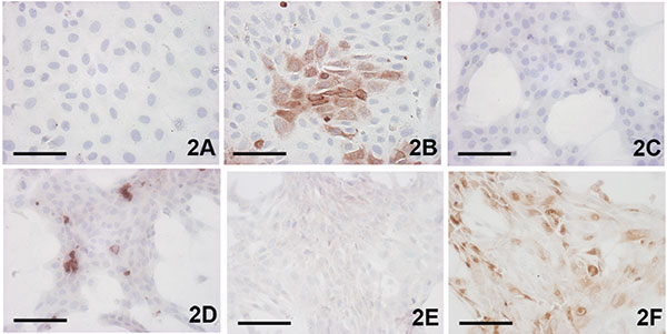 Demonstration of Usutu virus antigen 3 days postinfection. Immunohistochemical (IHC) tests were performed by using a polyclonal antibody to West Nile virus, which cross-reacts with Usutu virus. A) Vero control; B) Vero infected; C) CR (feline) control; D) CR infected; E) goose embryo fibroblast (GEF) control; F) GEF infected; A,B) bar = 50 μm; C–F) bar = 100 μm. †3 days postinfection (p.i.), IHC staining.