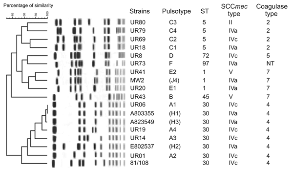 Dendrogram of pulsed-field gel electrophoresis (PFGE) banding pattern of representative Uruguay clone. Pulsotypes of representative Uruguay strains, a CA-MRSA strain isolated in the United States (MW2), 3 CA-MRSA strains isolated in Australia (A803355, A823549, and E802537), and a Japanese strain isolated from an outpatient (81/108) were compared by using a BioNumerics software program (Applied Maths, Sint-Martens-Latem, Belgium). Similarity coefficient was calculated by using Pearson correlatio