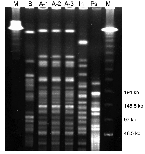 Pulsed-field gel electrophoresis of Inquilinus limosus. M, molecular weight marker 48.5 to 970 kbp (BioRad 170-3635); In, Inquilinus limosus type strain LMG 20952; Ps, Pseudomonas aeruginosa ATCC 27853.