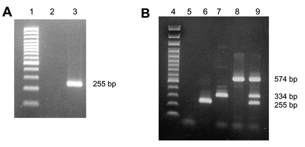 Ethidium bromide stain of 2% agarose gel showing reverse transcription–polymerase chain reaction (RT-PCR) products of human coronaviruses (HCoVs). A) Simple 1-step RT-PCR (HCoV-NL63, gene N): lane 1, size markers (100 bp); lane 2, negative control RT-PCR mix; lane 3, positive control HCoV-NL63. B) Multiplex 1-step RT-PCR (HCoVs NL63, OC43, 229E): lane 4, size markers (100 bp); lane 5, negative control RT-PCR mix; lane 6, positive control HCoV-NL63; lane 7, positive control HCoV-OC43; lane 8, pos