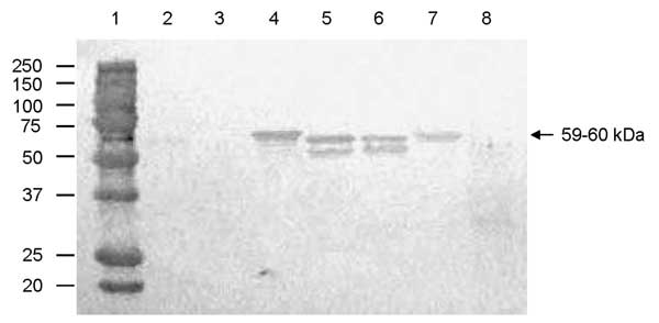 Antigenic cross-reactivity between human genogroup (G) II norovirus (NoV) capsid proteins and a pig convalescent-phase antiserum (LL616) against porcine QW101-like (GII-18) NoV was determined by Western blot. The CsCl-gradient purified viruslike particles (1,250 ng) were separated by sodium dodecyl sulfate 10% polyacrylamide gel electrophoresis, blotted onto nitrocellulose membranes, and tested with LL616. The sucrose-cushion (40%, wt/vol) purified Sf9 insect cell proteins acted as a negative co