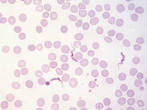 Trypomastigotes in a Giemsa-stained thin blood film of patient 2 (original magnification ×1,000).