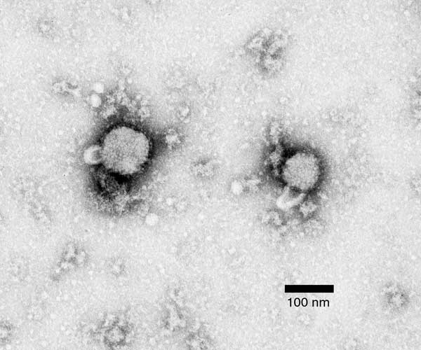 Methylamine tungstate negative-stain electron micrograph of arenavirus isolated from mouse spleen homogenate cultures that tested positive by immunofluorescence assay for lymphocytic choriomeningitis virus infection. Viral envelope spikes and projections are visible, and virion inclusions show a sandy appearance, indicating Arenaviridae.