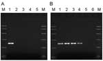 Thumbnail of A) Specificity of primers for PARV4. Samples in lanes 1–5 were amplified by using primers directed to open reading frame 1 (ORF1) of PARV4. Template DNA in lane 1 was a plasmid subclone of the PARV4 ORF1 region. In lane 2, the template DNA was derived from parvovirus B19 International Standard (99/800, National Institute for Biological Standards and Control, South Mimms, UK) as representative of genotype 1 erythrovirus sequences; in lane 3, the template DNA was derived from a genoty