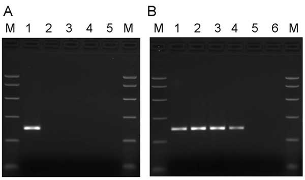 A) Specificity of primers for PARV4. Samples in lanes 1–5 were amplified by using primers directed to open reading frame 1 (ORF1) of PARV4. Template DNA in lane 1 was a plasmid subclone of the PARV4 ORF1 region. In lane 2, the template DNA was derived from parvovirus B19 International Standard (99/800, National Institute for Biological Standards and Control, South Mimms, UK) as representative of genotype 1 erythrovirus sequences; in lane 3, the template DNA was derived from a genotype 2 erythrov