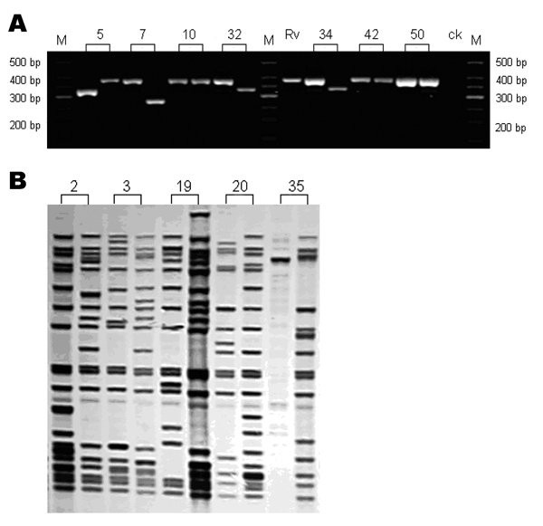 Genotyping analysis of clinical isolates from patients with recurrent tuberculosis. Numbers represented the patients' codes. A) Gel electrophoresis analysis of the PCR products of the mycobacterial interspersed repetitive unit (MIRU) locus 10. bp, base pair; M: DNA marker; Rv, H37Rv positive control; ck, negative control. B) IS6110 restriction fragment length polymorphism analysis of some patients with different MIRU patterns.