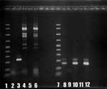 Thumbnail of Results of polymerase chain reaction showing 230-bp and 161-bp bands for Balamuthia (lanes 1–6) and Acanthamoeba (lanes 7–12) mitochondrial 16S rRNA gene DNA. Lane 1, molecular mass marker; lane 2, absence of Balamuthia DNA in patient brain tissue (5-μL sample); lane 3, positive control (Balamuthia DNA); lane 4, negative control (Acanthamoeba DNA); lane 5, negative control (water); lane 6, absence of Balamuthia DNA in patient brain tissue (1-μL sample); lane 7, molecular mass marker