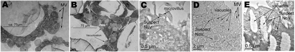 Light and transmission electron micrographs of uninfected and infected tissue aggregates with a combined stock of noroviruses representing 3 strains (Passage 0 [P0]). A) Uninfected tissue aggregates displaying well-formed microvilli. B) Infected tissue aggregates exhibiting vacuolization and shortening of the microvilli. C) Transmission electron microscopy (TEM) at 1 h postinfection showing possible norovirus in a microvillus. D) TEM at 24 h postinfection showing significant vacuolization, and i