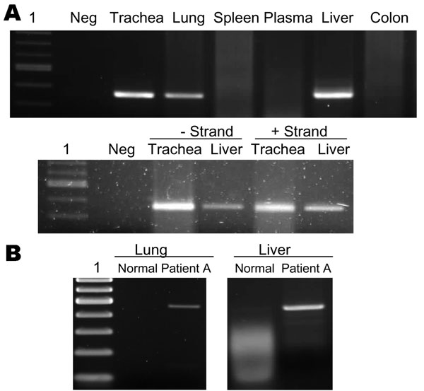 A) Detection of viral RNA in lung, trachea, and liver by reverse transcription–PCR (RT-PCR) (upper panel) and detection of positive- and negative-stranded viral RNA in trachea and liver by strand-specific RT-PCR (lower panel). Lane 1, 100-bp ladder; Neg, negative. B) RT-PCR showing overexpression of tumor necrosis factor-α in lung and liver tissues of patient in A compared with normal tissues.
