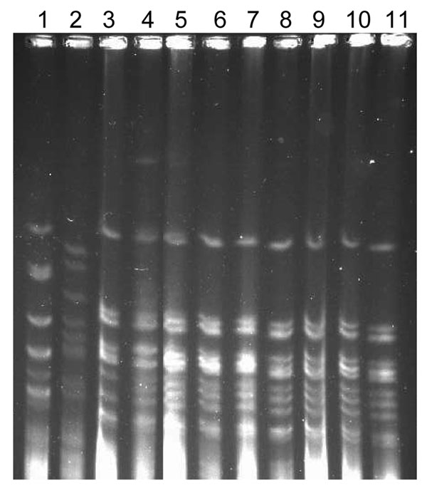 Pulsed-field gel electrophoresis (PFGE) pattern of the Neisseria meningitidis isolates from the outbreak. The chromosomal DNA digested with SpeI enzyme was separated by clamped homogeneous electric fields PFGE (BioRad, Hercules, CA, USA). 1, RRL-1; 2, RRL-2; 3, SFDJ 723; 4, Ap-II 420; 5, SFDJ E-95; 6, IR-I 442, 7, IR-II 440; 8, SFDJ E-100; 9, SFDJ 184; 10, SFDJ E-79; 11, NICD 18.