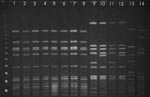 Thumbnail of Pulsed-field gel electrophoresis patterns of SmaI-digested DNA of bovine and human strains of Staphyloccocus aureus isolated from cows with subclinical mastitis, Hungary, January 2002–December 2004.