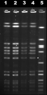 Thumbnail of Pulsed-field gel electrophoresis profiles of November and February blood isolates (lanes 1 and 2), April lumbar isolate (lane 3), reference USA300-0114 isolate (lane 4), and internal control g195a (lane 5).