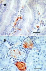 Thumbnail of Sections of chipmunk tissues 9 days after intramuscular inoculation with West Nile virus (WNV). A) Lesions were absent, but WNV antigen (brown staining) was demonstrated in scattered epithelial cells and in macrophagelike cells in the lamina propria of the small intestine. B) WNV antigen (brown staining) was demonstrated in necrotic renal tubular epithelial cells. Tissues were stained with hematoxylin, and WNV-specific mouse ascites fluid (ATCC Catalog #VR01267CAF) was used as the primary antibody for immunohistochemical staining. Scale bars = 50 μm.