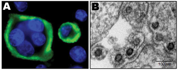 Simian foamy virus; Chimpanzee foamy virus; Chimpanzee foamy virus