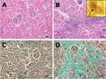 Thumbnail of A) Normal renal parenchyma from wild boar seropositive for Leptospira spp. (hematoxylin and eosin [HE] staining). B) Kidney from a seropositive wild boar, showing chronic interstitial nephritis (HE staining). Inset: silver-stained leptospire (arrow) within the tubulus epithelium of the kidney (Warthin-Starry, oil ×1,000). C) Normal renal parenchyma (Masson trichrome staining). D) Kidney with severe interstitial fibrosis (green) as a result of chronic interstitial nephritis in a wild boar seropositive for Leptospira spp. (Masson trichrome staining). Scale bars represent 50 μm.