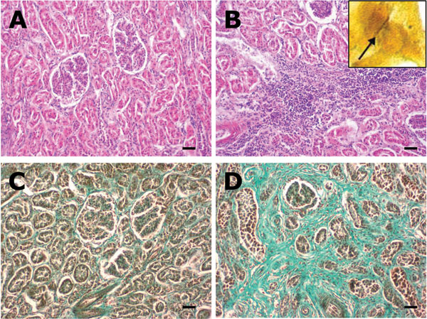 A) Normal renal parenchyma from wild boar seropositive for Leptospira spp. (hematoxylin and eosin [HE] staining). B) Kidney from a seropositive wild boar, showing chronic interstitial nephritis (HE staining). Inset: silver-stained leptospire (arrow) within the tubulus epithelium of the kidney (Warthin-Starry, oil ×1,000). C) Normal renal parenchyma (Masson trichrome staining). D) Kidney with severe interstitial fibrosis (green) as a result of chronic interstitial nephritis in a wild boar seropositive for Leptospira spp. (Masson trichrome staining). Scale bars represent 50 μm.