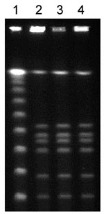 Thumbnail of Fingerprint patterns obtained for Clostridium botulinum isolates following pulsed-field gel electrophoresis after SmaI restriction show identical strains. Lane 1, 100-bp ladder; lanes 2–4, abscess fluid isolates from patients 2, 3, and 4, respectively.