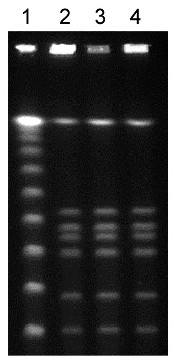 Fingerprint patterns obtained for Clostridium botulinum isolates following pulsed-field gel electrophoresis after SmaI restriction show identical strains. Lane 1, 100-bp ladder; lanes 2–4, abscess fluid isolates from patients 2, 3, and 4, respectively.