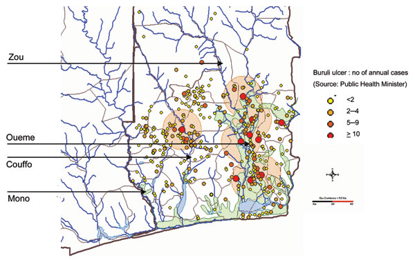 Concentration of Buruli ulcer cases along the major Benin rivers, the Oueme and Couffo.