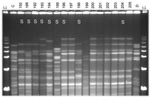 Thumbnail of Pulsed-field gel electrophoresis (PFGE) analysis of chromosomal DNA from pharyngeal meningococcus isolates (stained with ethidium bromide). Whole chromosome DNA macrorestriction fragments were generated by digestion with endonuclease SpeI. Shown are examples of sequence type (ST) prediction by PFGE in carried meningococci and diversity among STs types. S, isolates tested by multilocus sequence typing (MLST). Lanes λ (arrows) PFGE marker I (Boehringer Mannheim, Mannheim, Germany); lane C, ST-2881, meningitis case isolate, Niger 2003; lanes 155, 166, and 192–194, ST-192, NG:NT:NST; lane 195, ST-198, NG:15:P1.6; lanes 196–198, ST-192, NG:NT:NST; lane 199, isolate unrelated to the presented study; lanes 200–205, ST-192, NG:NT:NST; lane D, meningitis case isolate, ST-11, Niger 2003. Isolates 192, 193, 194, 196, 198, and 204 were identified as ST-192 by MLST. Isolates 197, 200, 201, 202, and 203 are indistinguishable from isolate 196 and are thus considered ST-192. ST-192 isolates from this study had 10 different PFGE patterns, of which 6 are represented by isolates 155, 166, 192, 194, 196, and 204.