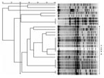 Thumbnail of Pulsed-field gel electrophoresis (PFGE) banding patterns of chromosomal DNA of 26 isolates of vancomycin-resistant enterococci. There is a clear predominant type, classified as type A (≥80% similarity), composed of 18 isolates of Enterococcus faecium. There are at least 3 subtypes that display a 100% similarity.