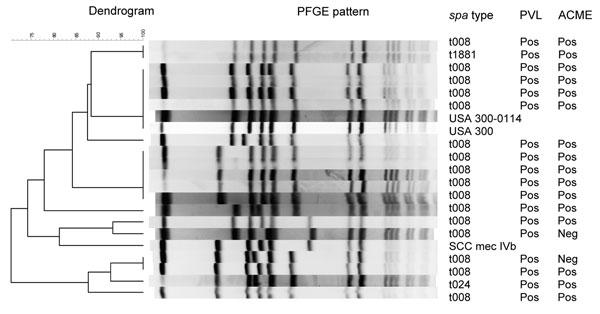Pulsed-field gel electrophoresis (PFGE) of a stratified random sample of USA300 isolates and corresponding PCR results for Panton-Valentine leukocidin (PVL) and arginine catabolic mobile element (ACME). The Centers for Disease Control and Prevention’s PFGE results for USA300, USA300-0114, and SCCmec IVb were added as controls.