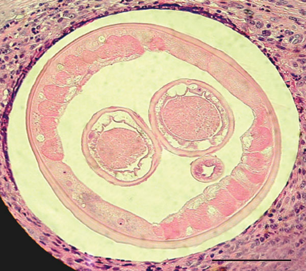 Transverse section of a female worm and surrounding tissue isolated from the patient (hematoxylin and eosin stained). Scale bar = 100 μm.
