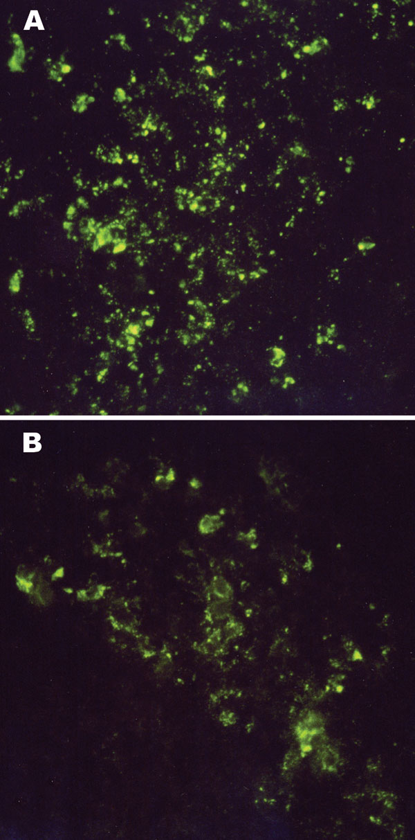 Intracytoplasmic virus-specific fluorescence in brain tissues of an 11-day-old Mongolian gerbil (A) and a 10-day-old NIH Swiss mouse (B) injected intracerebrally with 6,000 PFU of Thottapalayam virus (TPMV) strain VRC-66412 from serum of an adult rat injected intramuscularly with TPMV (original magnification, x400).
