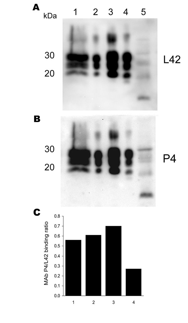 Antibody-binding patterns of the prion protein (PrPSc) associated with cases of ARR/ARR scrapie in France and Germany. A) and B) Western blots showing the differences in monoclonal antibody (MAb) P4 binding compared with the internal standard MAb L42 of PrPSc derived from S115/04 (ARR/ARR Germany), S83 (ARR/ARR France), ovine ARQ/ARQ bovine spongiform encephalopathy (BSE), and S95 (classic scrapie) cases. Banding intensities were quantified by photoimaging, and binding ratios were calculated. Note the significantly weaker P4 binding to the ovine BSE sample. Lane 1, S115/04; lane 2, S83; lane 3, S95; lane 4, ovine BSE; lane 5, atypical S15. C) Relative MAb binding ratios for lane nos. 1–4 in the Western blots shown in A) and B).