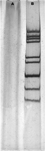 Thumbnail of Polyacrylamide gel electrophoresis of rotavirus RNA. The viral RNAs were analyzed by electrophoresis in a polyacrylamide gel and visualized by silver staining. A, negative control; B, Wuhan G9 strain (CC589).