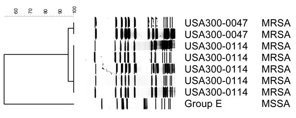 Dendrogram of pulsed-field types for methicillin-resistant Staphylococcus aureus (MRSA) and methicillin-susceptible S. aureus (MSSA) isolated from methamphetamine users.