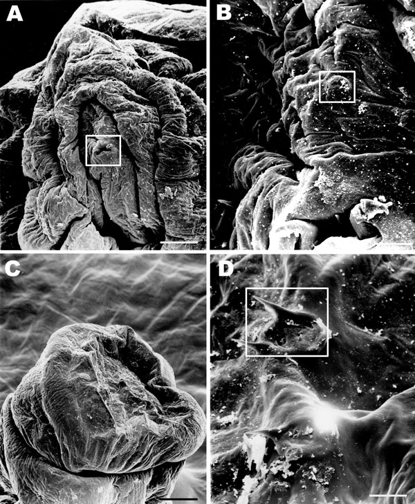 Figure 2&nbsp;-&nbsp;Scanning electron microscope images of the parasite from an 11-year-old Inuit boy, Nunavut, Canada. A) Anterior end of the maggot. The cephalic segment is evident; mouth and mouth hooks are present (boxed). Scale bar = 50 μm. B) The characteristic cephalic sensory array (boxed). Scale bar = 10 μm. C) Posterior segments of the maggot. Scale bar = 100 μm. D) Spiracular openings on the posterior segments of the maggot characteristic of first instar of Hypoderma. Scale bar = 10