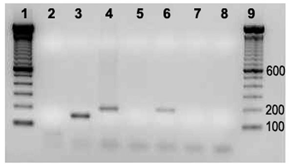 PCR amplification of internal transcribed spacer 16S–23S on vegative and normal-appearing valves of cows 04–927 and 05–1406. 1, Molecular weight marker; 2, negative control; 3, Bartonella quintana; 4, B. bovis; 5 and 6, normal appearing and vegetative valves (Cow 04–927); 7 and 8, normal appearing and vegetative valves (Cow 05–1406); 9, molecular weight marker.