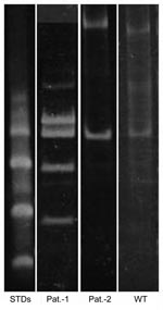 Thumbnail of Polyacrylamide gel electrophoresis–restriction fragment length polymorphism of PCR amplicons digested with HaeIII with standards. STDs, sexually transmitted diseases; Pat., patient; WT, wild type.